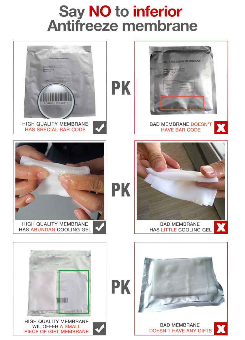 Freezefat anti freezing membrane