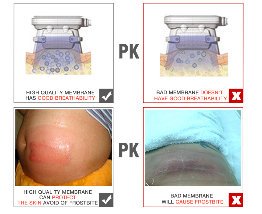 Freezefat anti freezing membrane