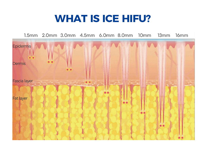 What kind of hifu machine can i buy