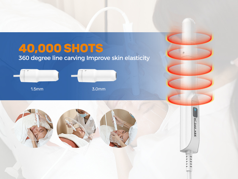 hifu machine philippines for skin lifting anti aging