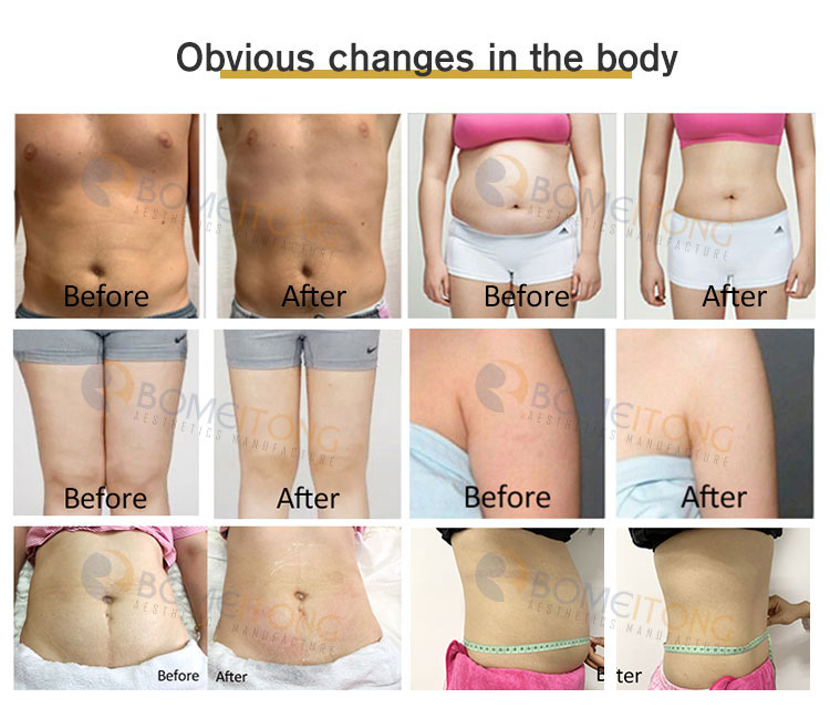 6d Laser 532nm 635nm Body Shape Machine