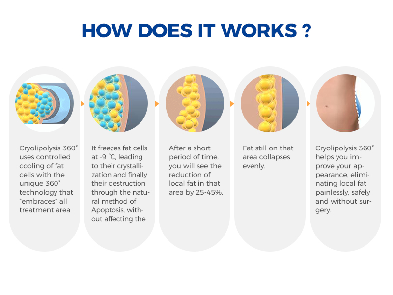 Cryolipolysis Machine Freeze Fat 360 Body Shaping Beauty Slimming ETG80S