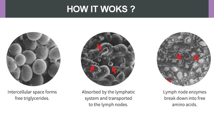 10d Laser Slimming Luxmaster Slim Cold Laser Therapy Device