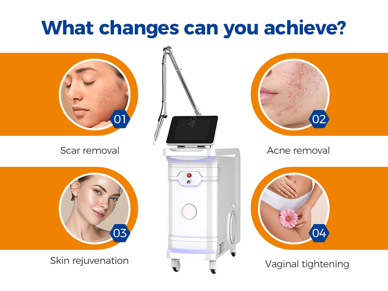 Buy Fractional Co2 Laser Machine