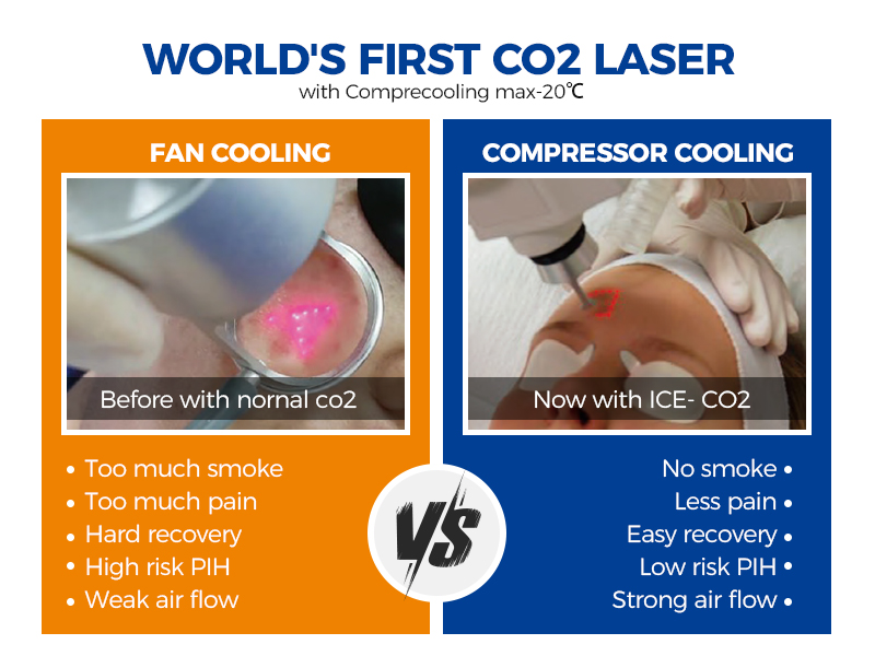 Buy Fractional Co2 Laser Machine