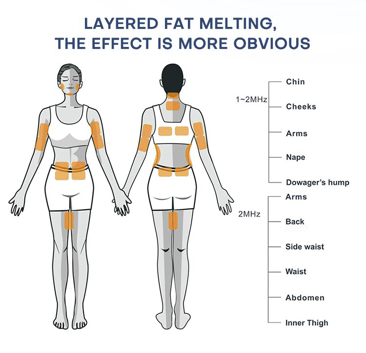 EMS Monopolar RF Sculpting Machine Radio Frequency