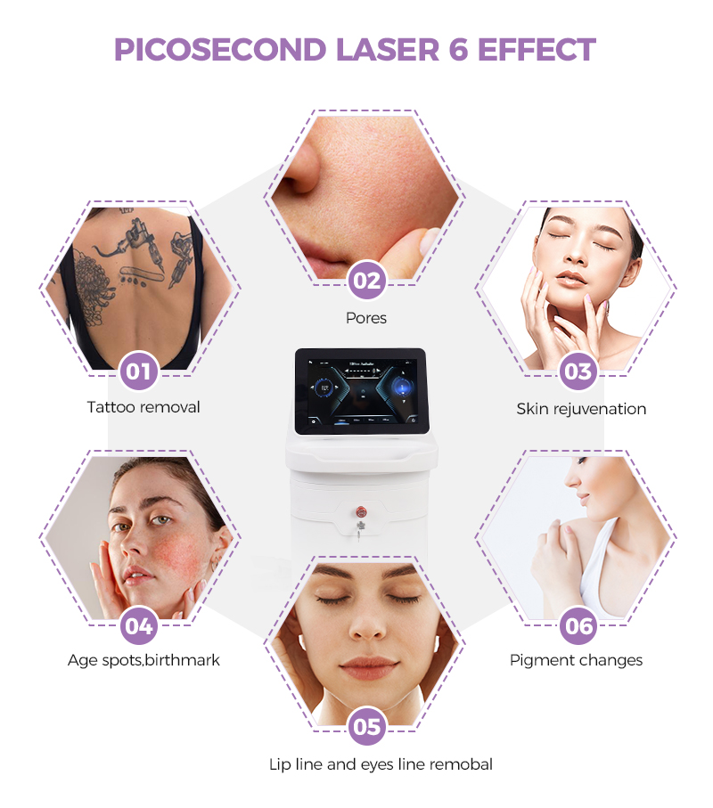 Laser Tattoo Removal Machine for Sale