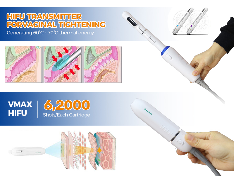 What kind of hifu machine can i buy