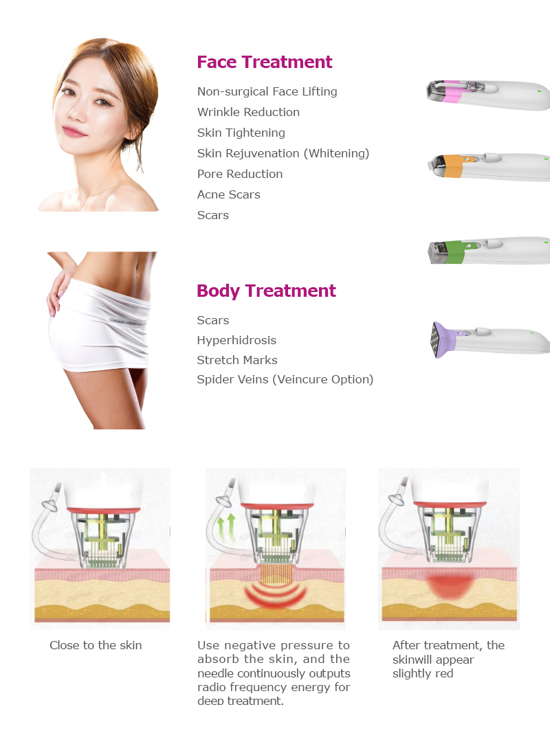 2025 Professional Microneedling Device for Clinics