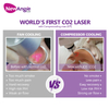Portable High Powerful Co2 Fractional Laser Vaginal Tightening Equipment