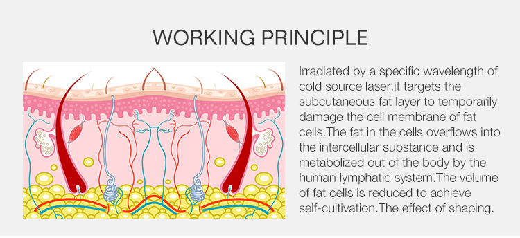 532nm Laser 6D Laser Non-invasive Laser Slimming Equipment Painless