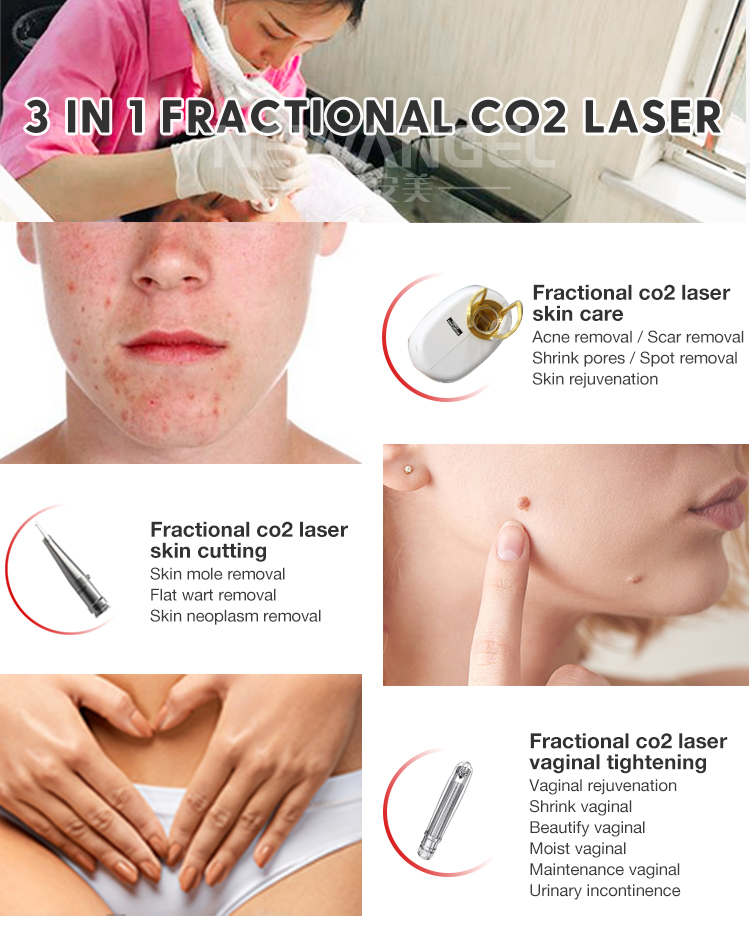 Best Fractional Co2 Laser Machine for Salon And Spa