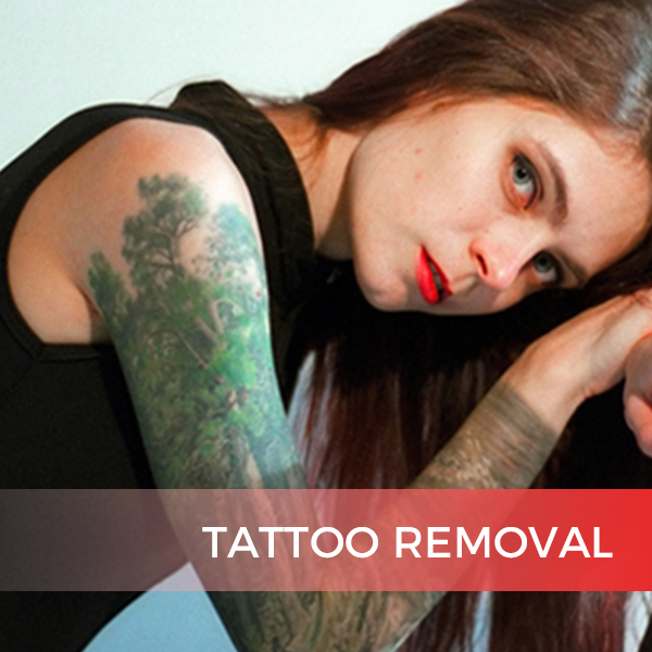 Laser Tattoo Removal Machine: A Revolutionary Solution for Tattoo Regrets