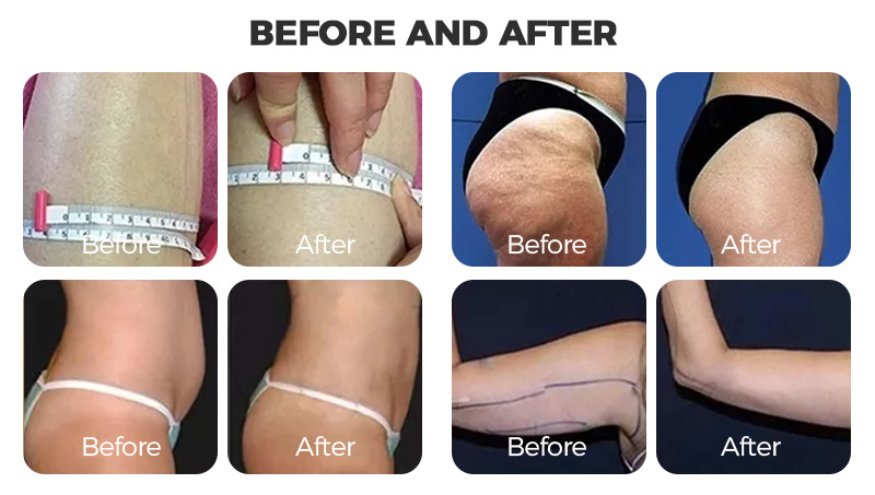 Cavitation machine fat slimming professional ultrasonic vacuum beauty