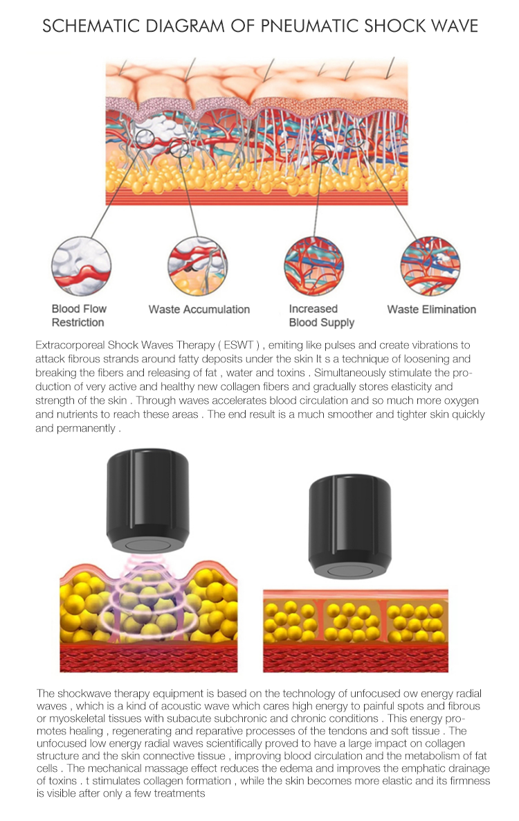 Pain Relief Shock Wave Therapy Machine Focused Pneumatic Shockwave ...