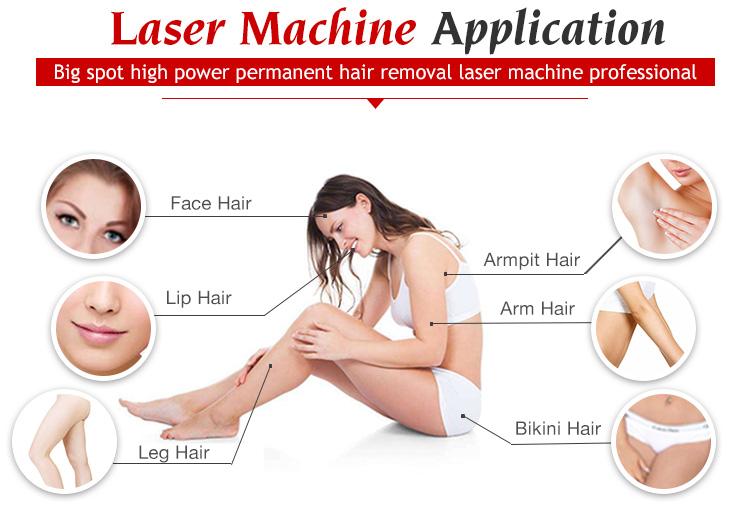 permanent hair removal price