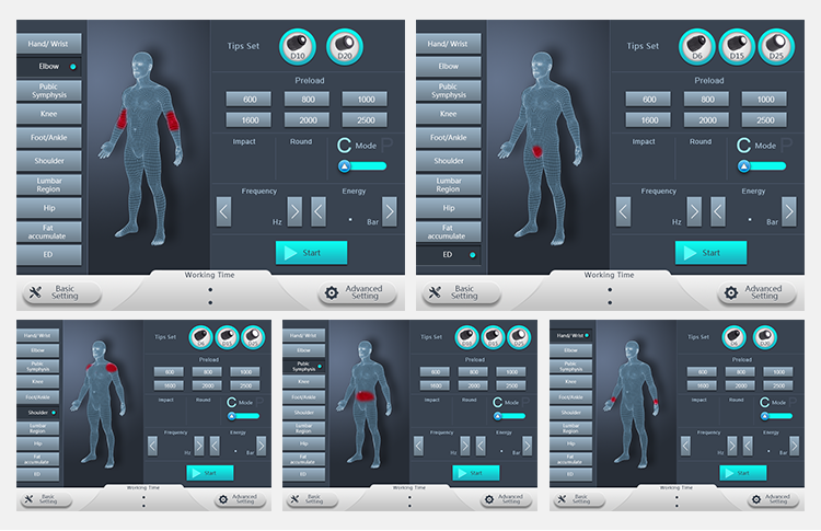 Portable Shockwave Therapy Machine Extracorporeal Pneumatic Shock Wave Therapy for ED