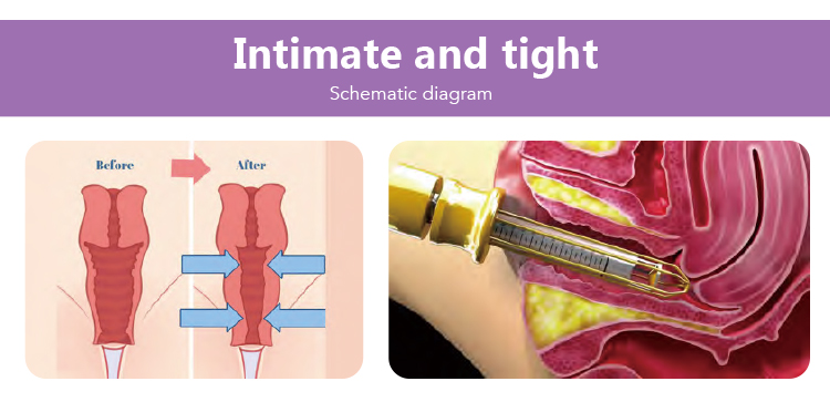 Co2 Fractional Laser Machine Fractional Co2 Laser Scar Removal Skin Resurfacing