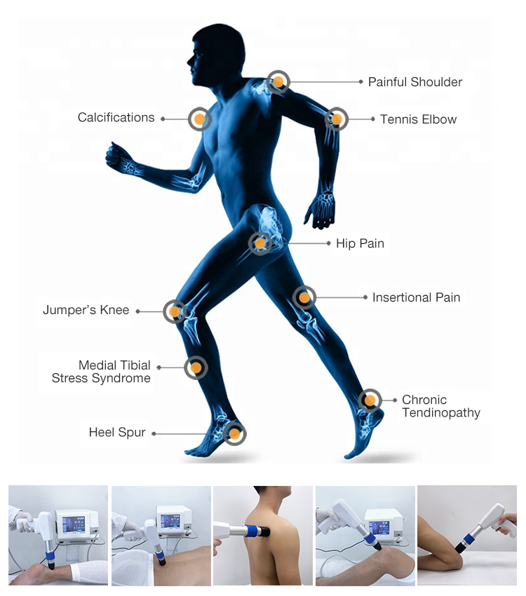 Latest Air Pressure Shock Wave Therapy Machine Ed Treatment Pain Relief