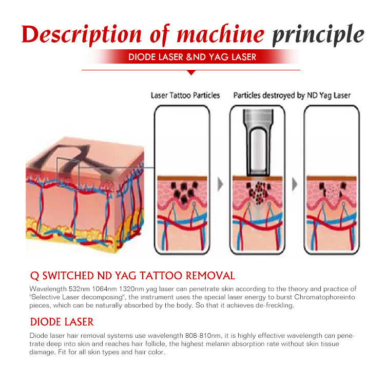 q switch nd yag laser all colors tattoo removal machine CE approved clinic salon skin rejuvenation 532 1064 1320nm