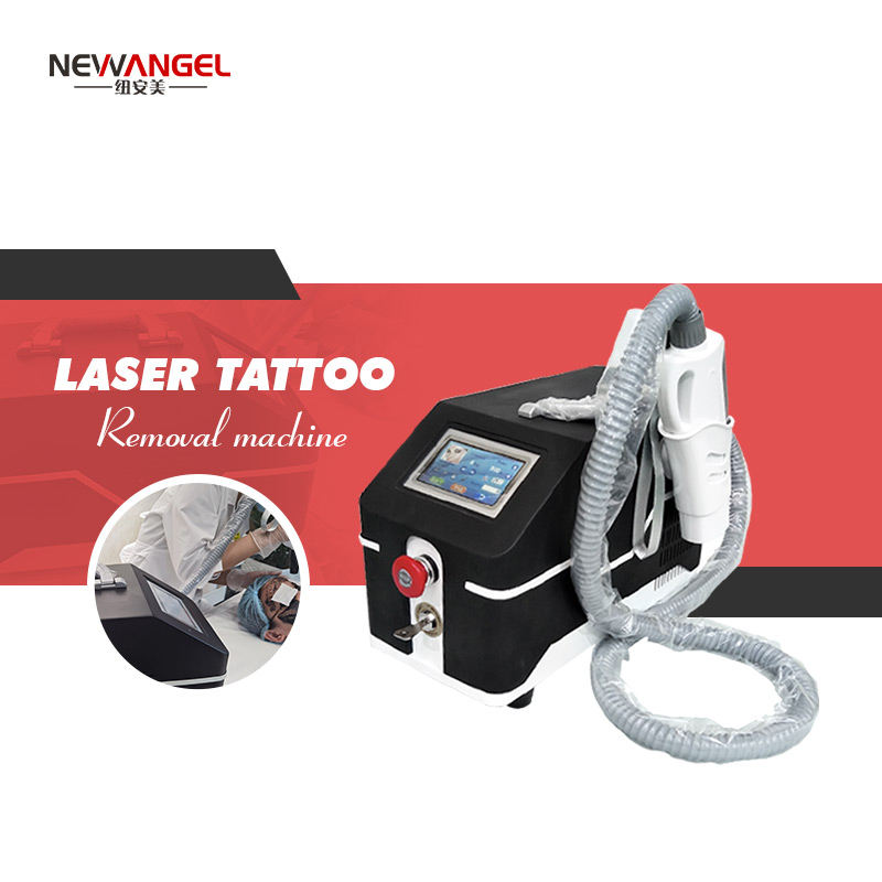 Laser Treatment for Tattoo Removal Cost
