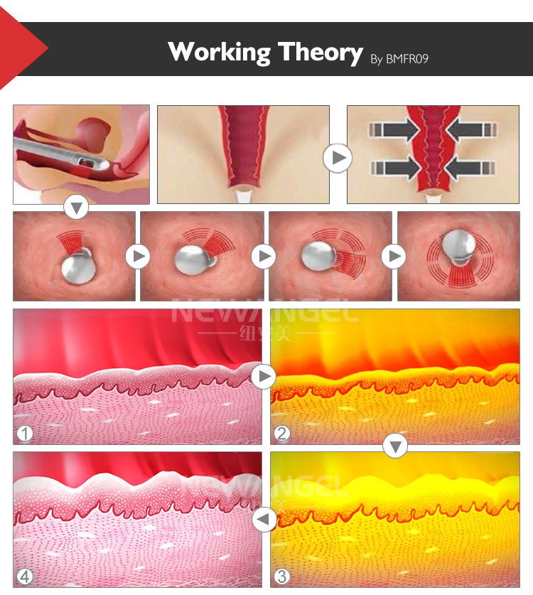 Best Fractional Co2 Laser Machine for Salon And Spa