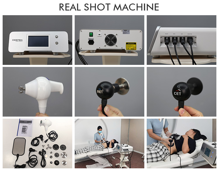 Deep Body Health Care 448khz Physio Back Knee Pain Relief Tecar Therapy Rf Machine