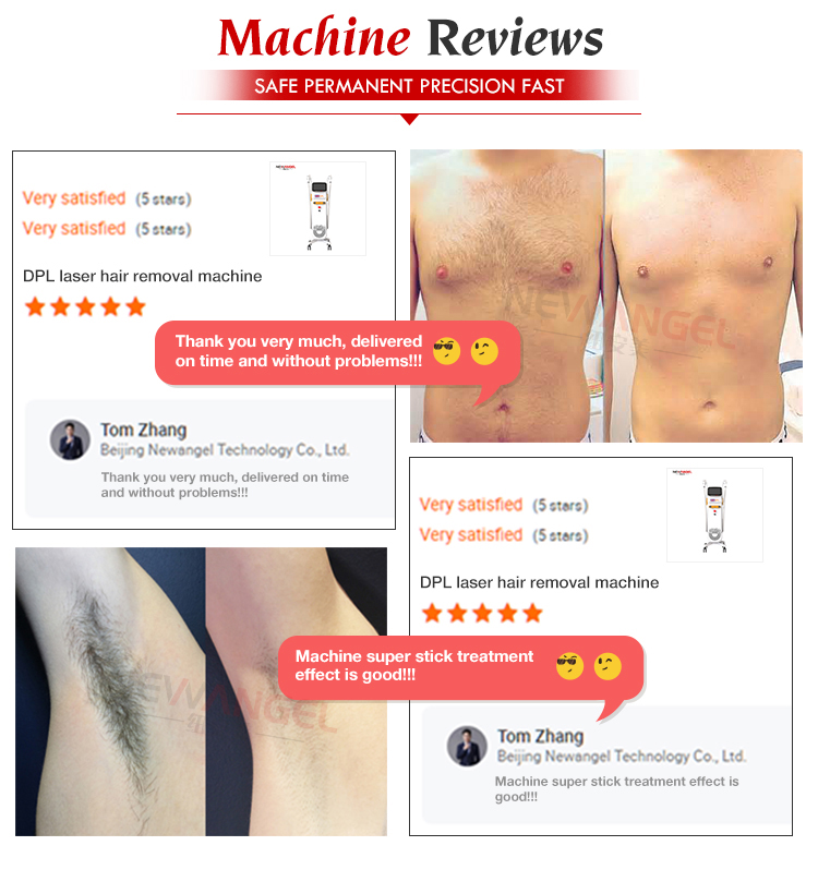 IPL Laser Hair Removal Machine Dpl Permanent Painless Factory Wholesale Price Facial Care Professional Skin Rejuvenation