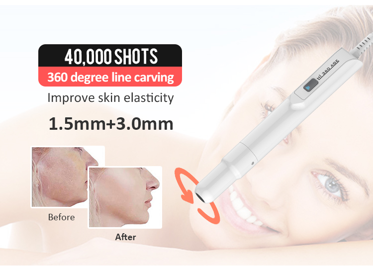 Hifu treatment for face machine