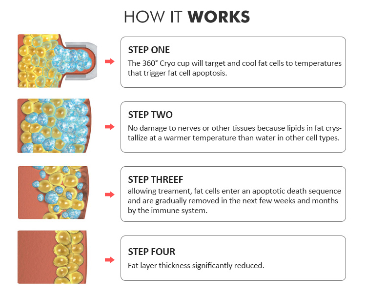 360&deg; Cryolipolisis Weight Loss Machine Fat Freezing ETG50-8S