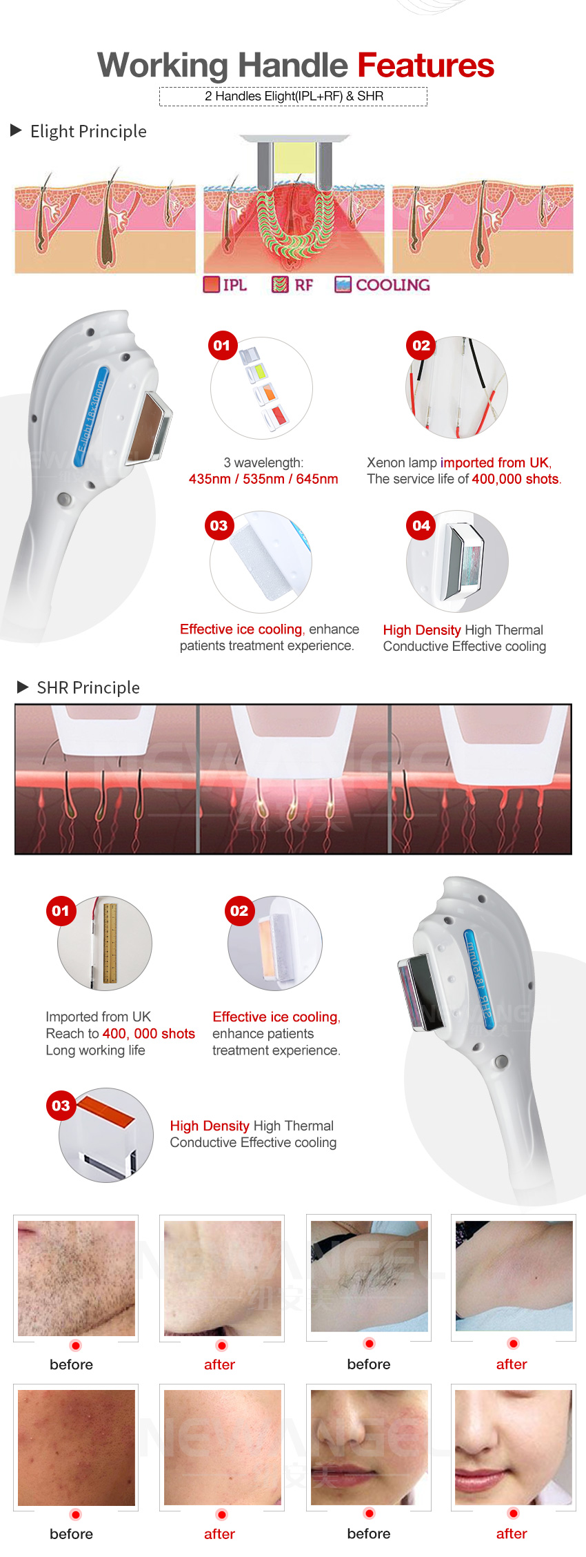 Ipl hair remover machine best e-light skin rejuvenation for uk