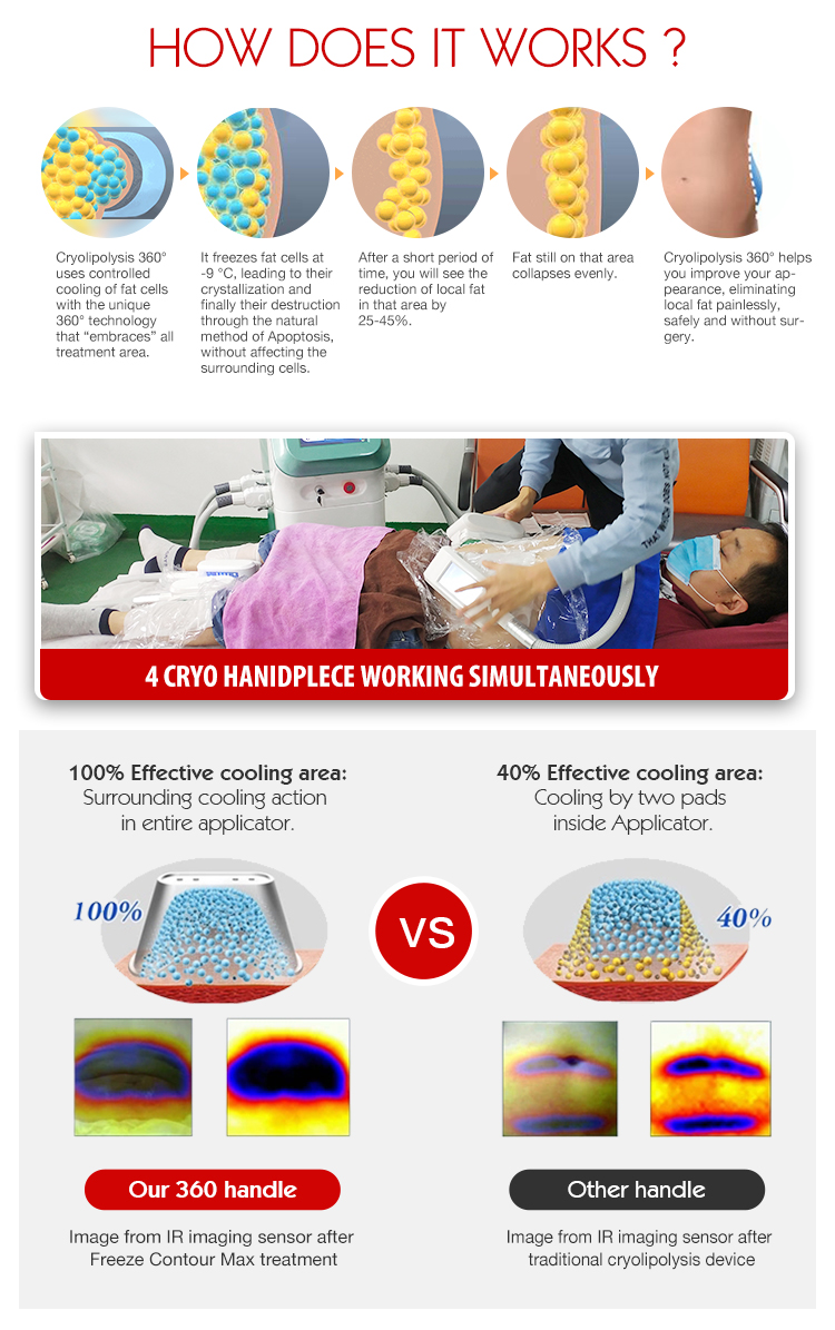 Cryolipolysis machine price 360 Degree freezing Body Slimming beauty salon