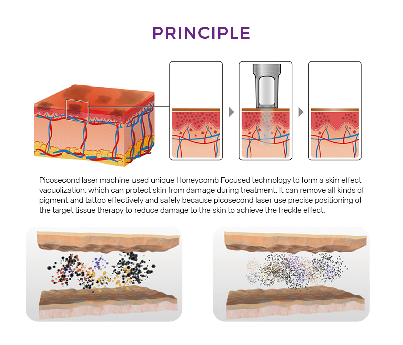 lQDPKHUQEU7R8W3NAq7NAyCwIvJLMotu2JEGDbzDM-GGAA_800_686