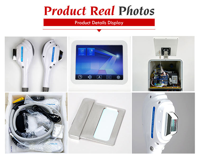 Laser hair removal chin cost machine for 2020 hot sale