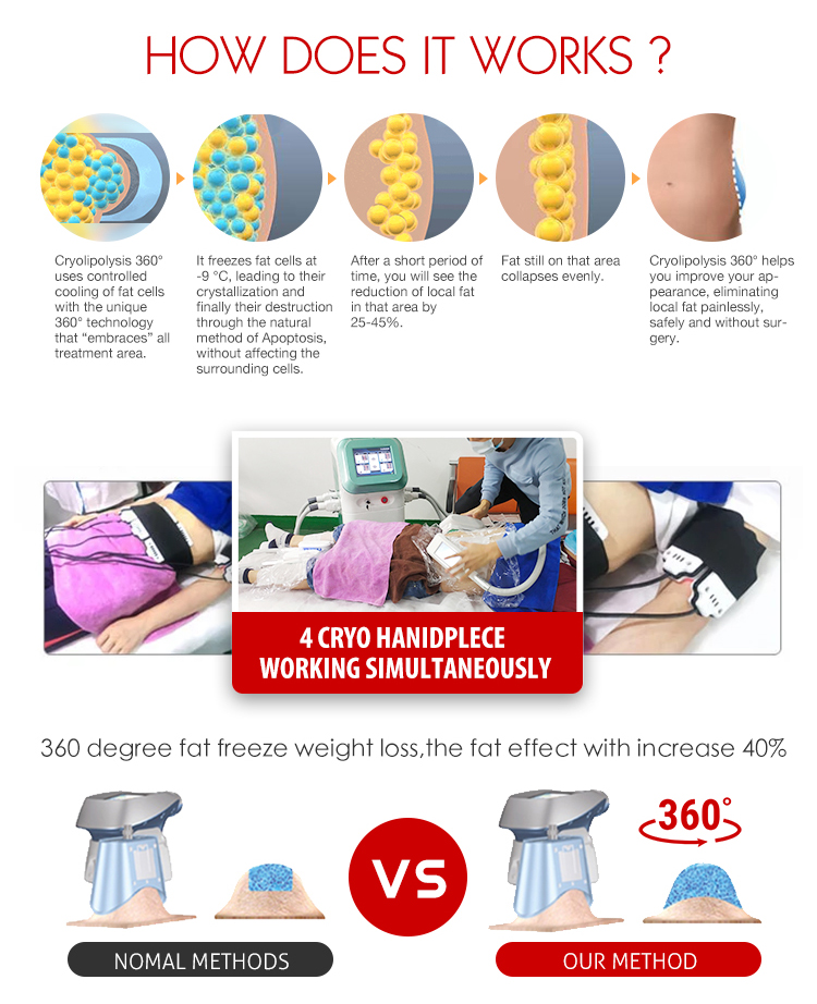 Laser belly fat removal cost machine rf cavitation for beauty salon use