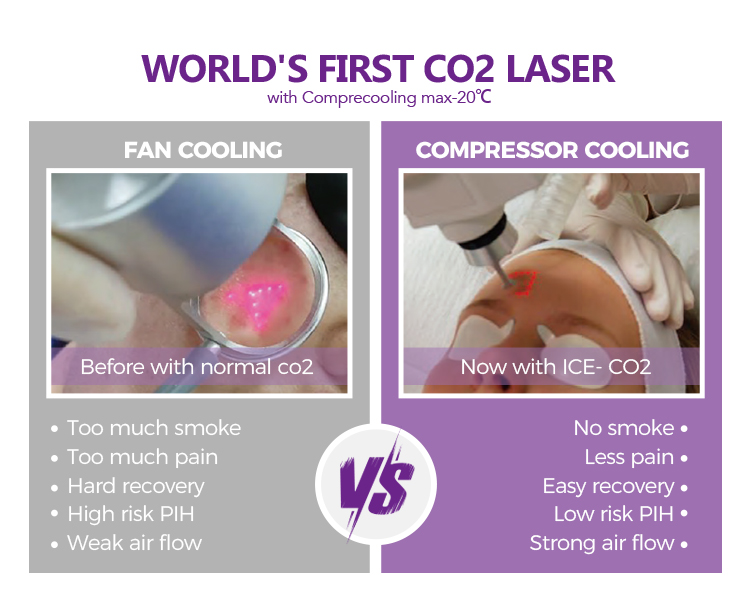 Co2 Fractional Laser Machine Fractional Co2 Laser Scar Removal Skin Resurfacing