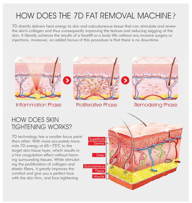 Newangel 7d Facial Skin Tightening Wrinkle Removal Body Slimming Machine