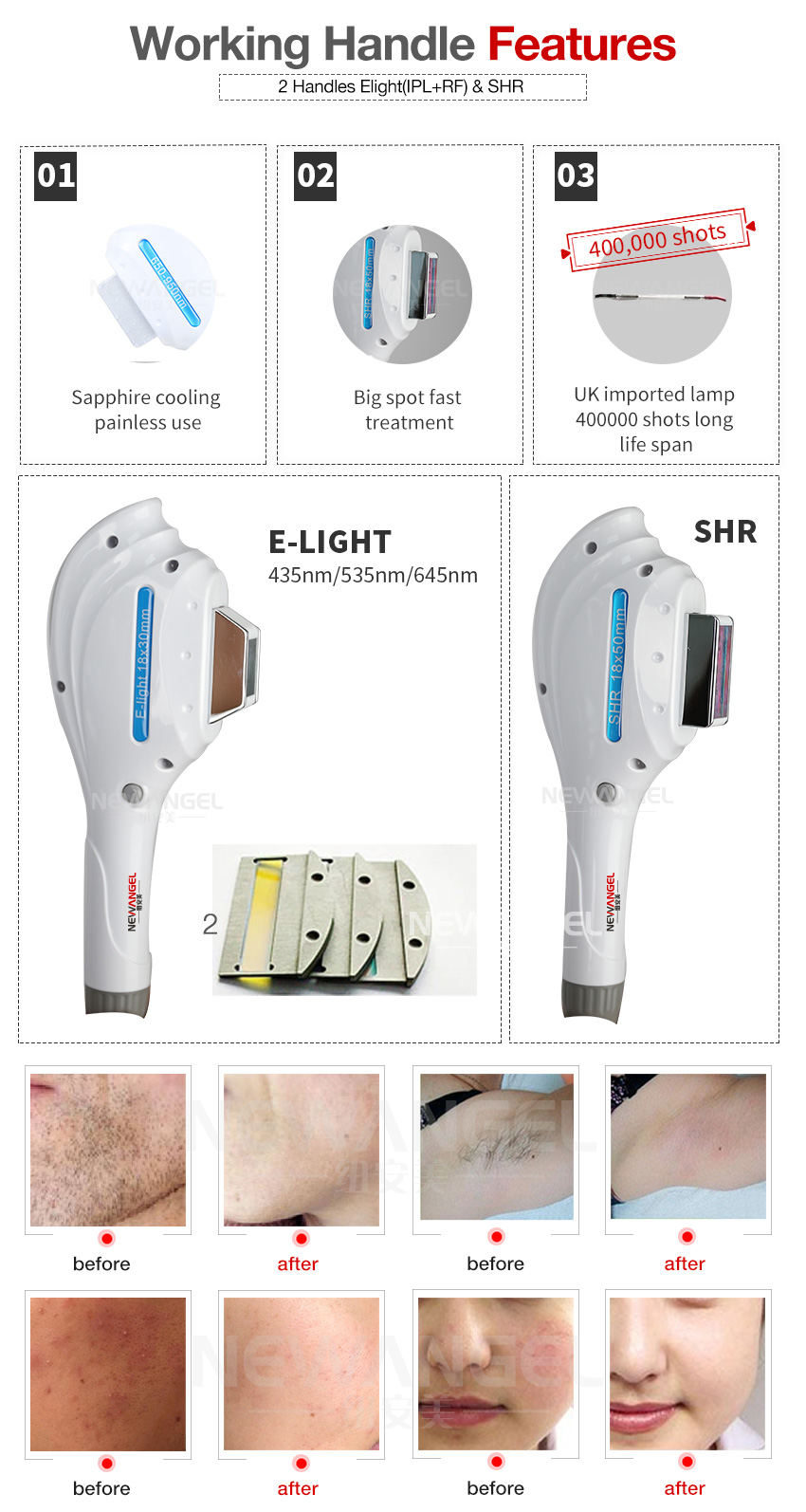 Ipl underarm hair removal shr e-light laser machine for sale