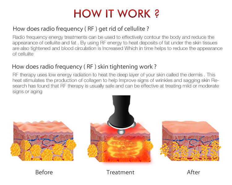 360 Rf Radio Frequency Machine Face Lifting Device RF Facial Body Massager with LED
