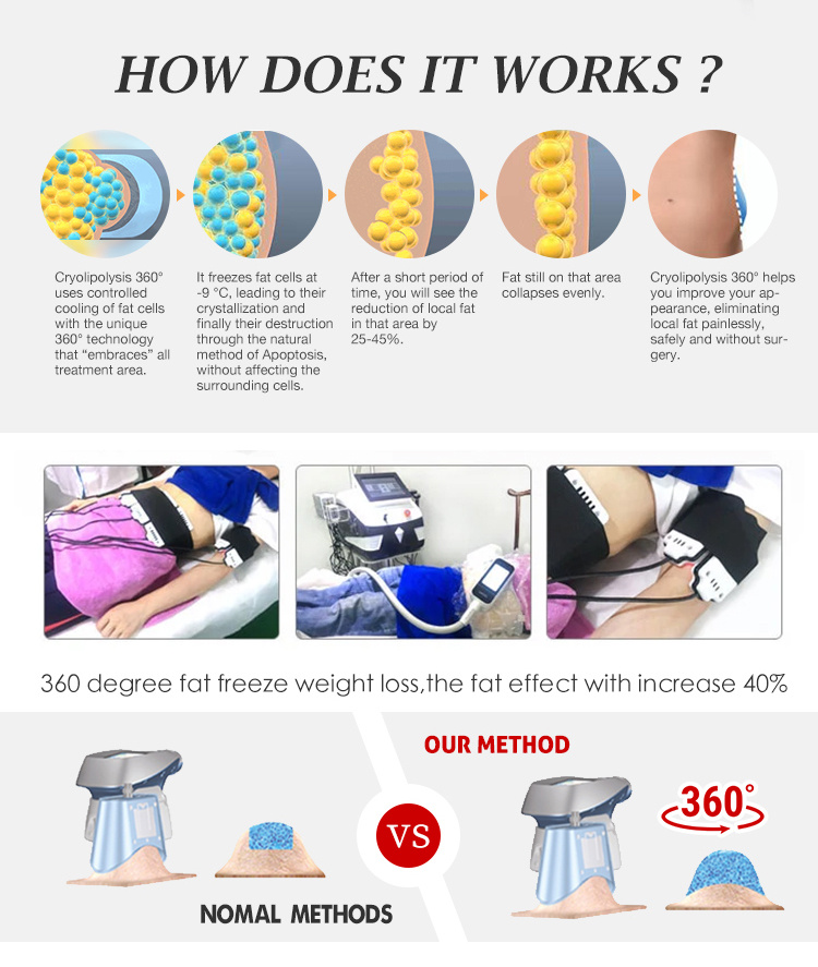 Subcutaneous fat removal cryolipolysis machine cellulite reduction 360 cavitation