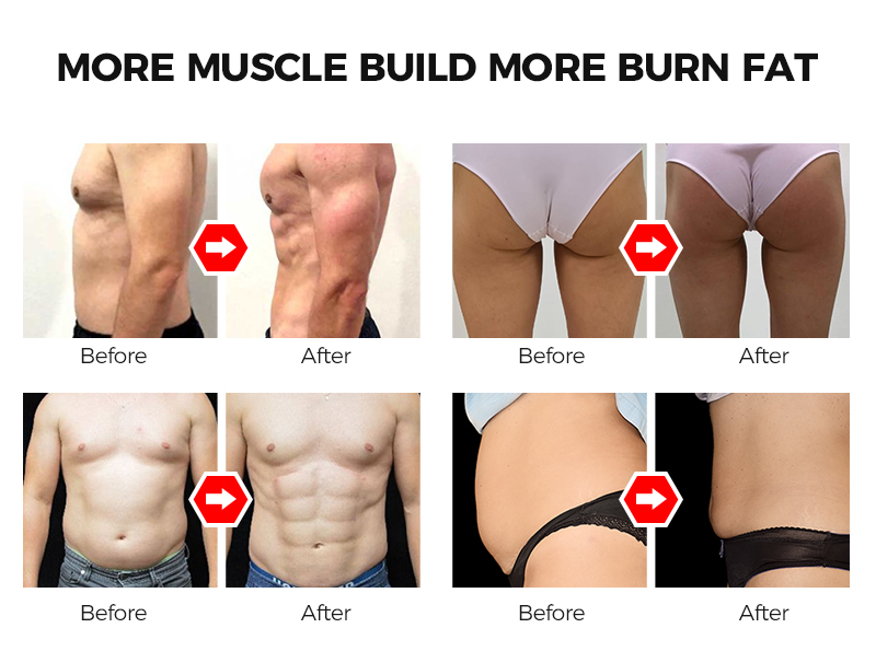 High intensity focused electromagnetic therapy machine muscle stimulator