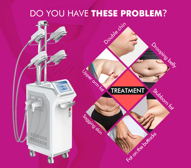 Cryolipolisis Body Slimming Belt Fat Freezing 360 Cryo Machine