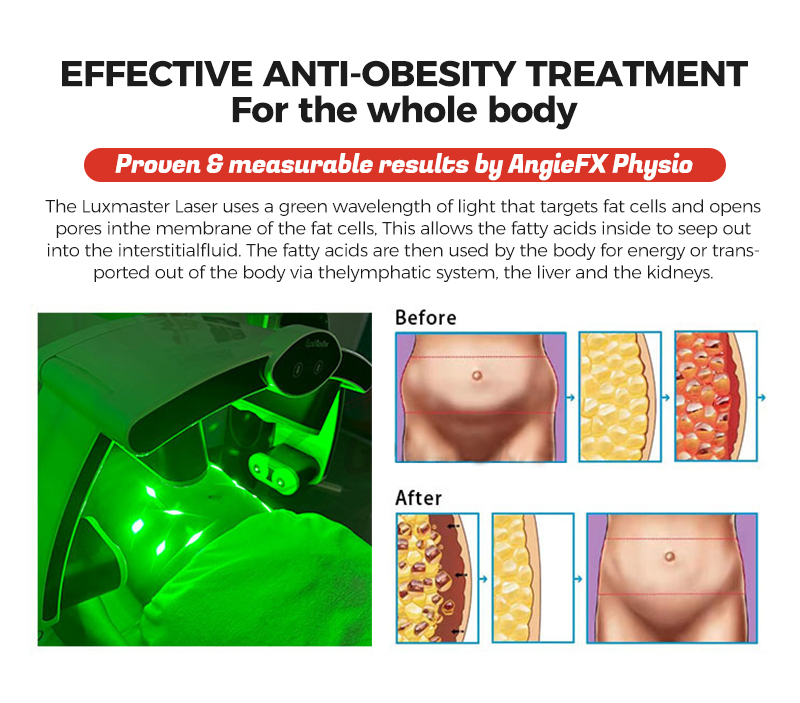 532nm Wavelength 10D Laser Machine Green Light Fat Loss Body Slimming