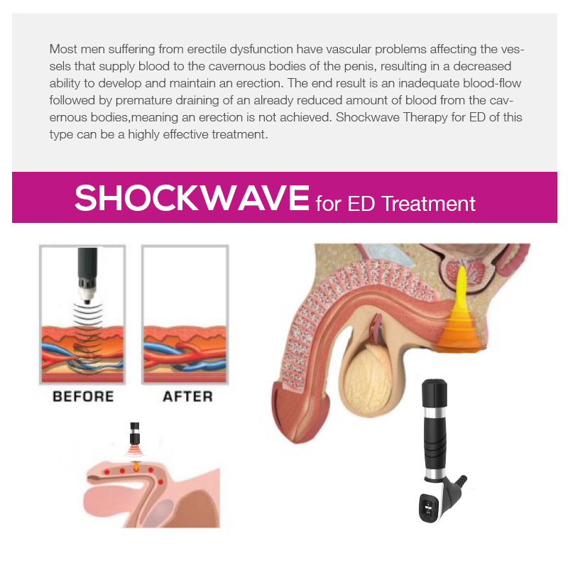 Shockwave therapy for ed machine touch screen intelligent system
