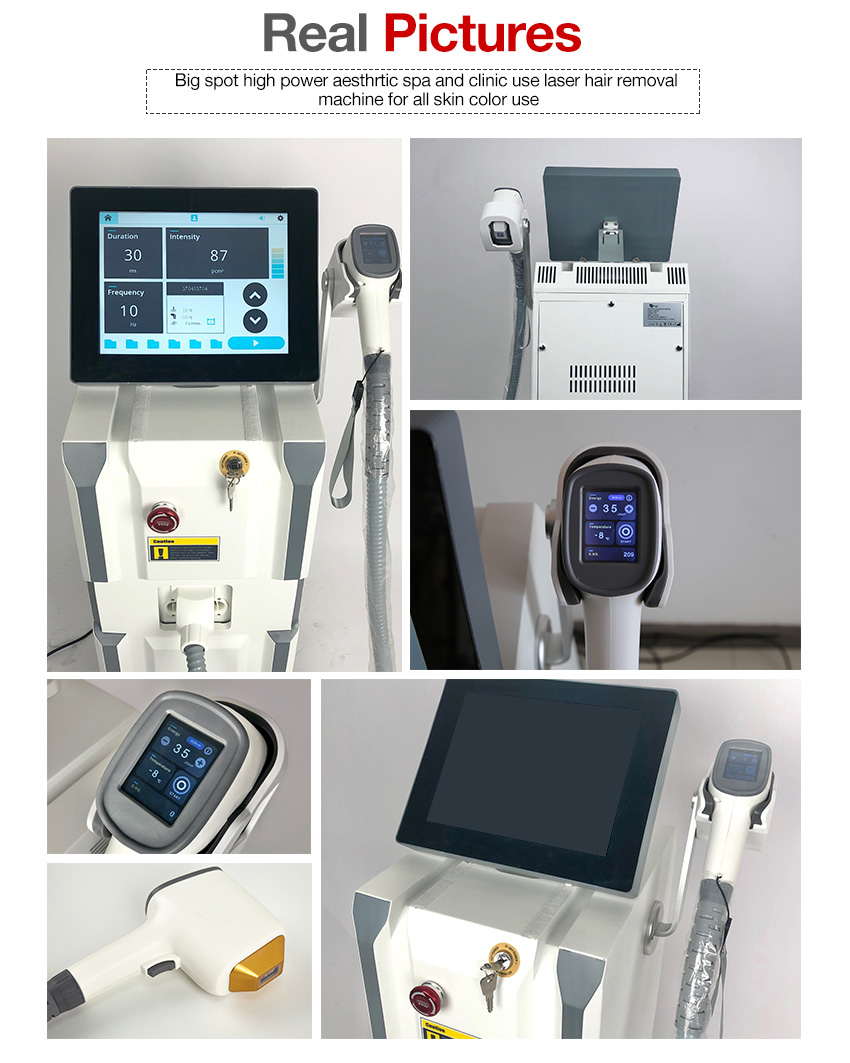 Laser hair removal african american skin diode laser machine