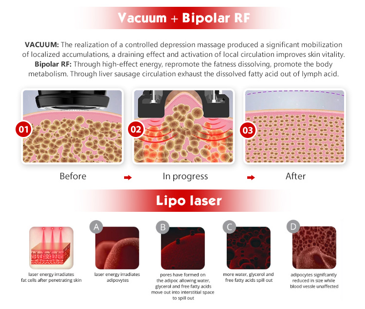 RU+6 6 in 1 RF Cavitation Body Shaping Slimming Vacuum Cavitation System Machine