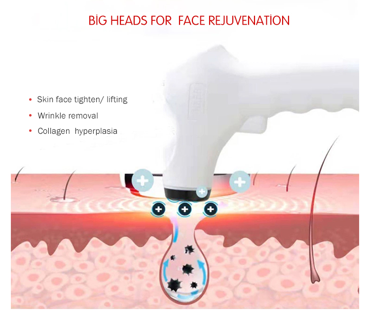 Best RF Radio Frequency Skin Tightening Machines for face
