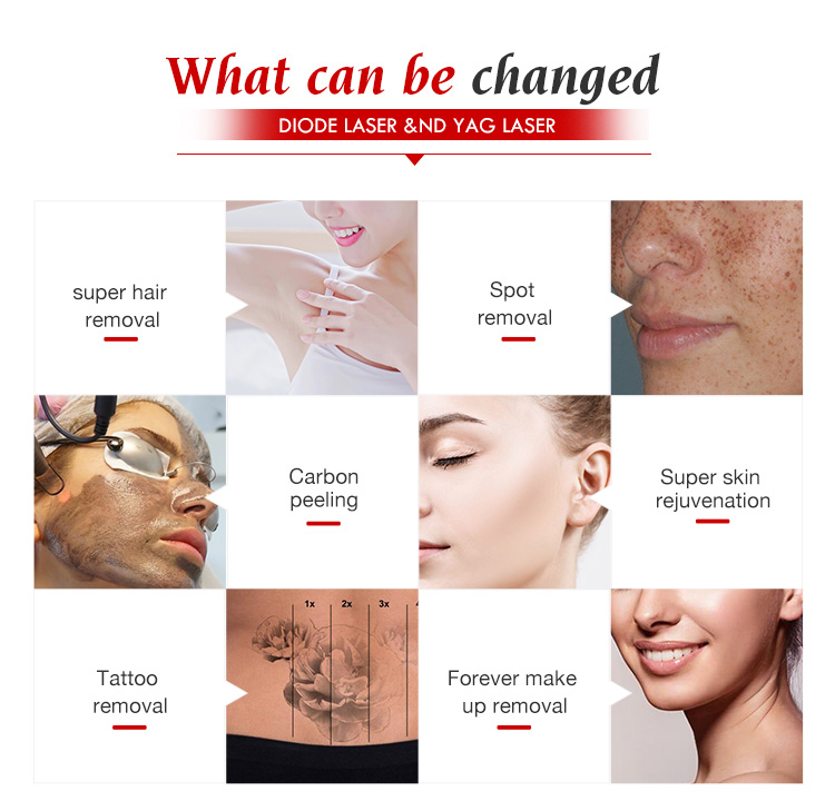 Diode laser hair removal machine q switched nd yag treatment system 2 in 1