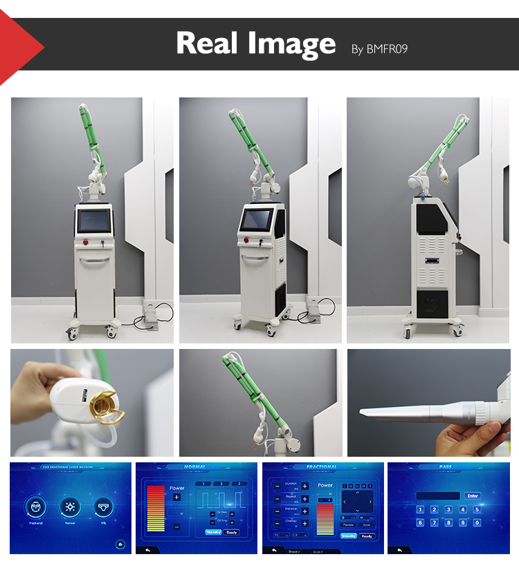 Best Fractional Co2 Laser Machine for Salon And Spa