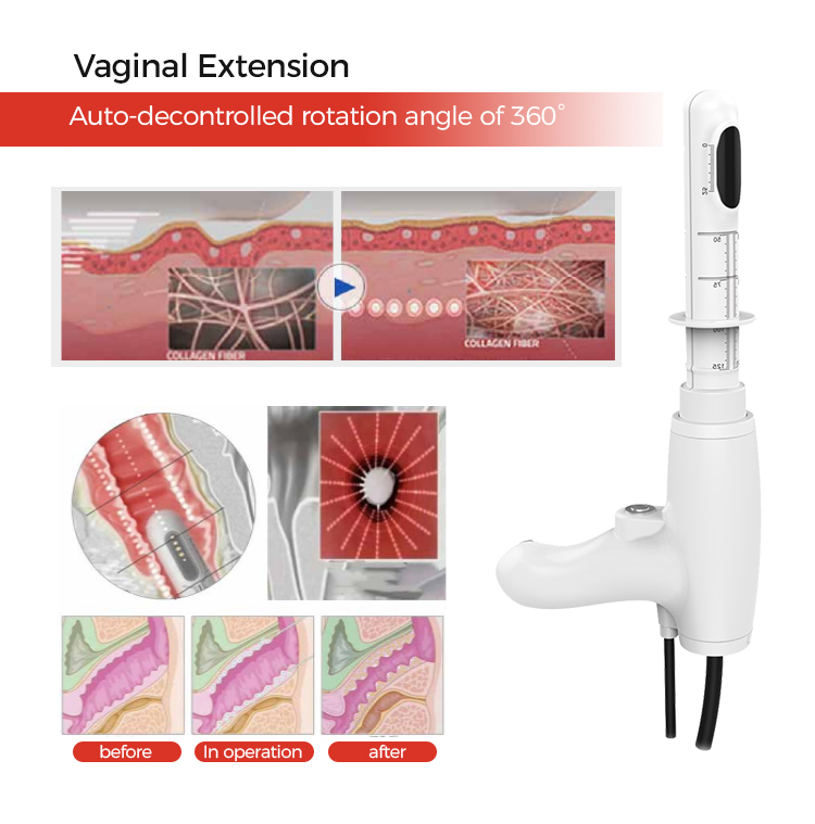 Hifu treatment for face machine